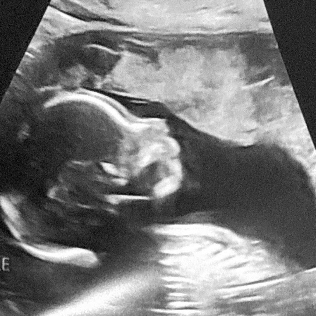 Photo shared by Diana for their Babylist baby registry.