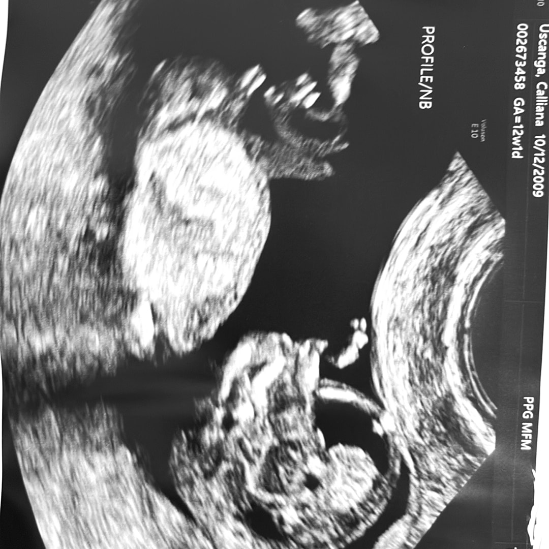 Photo shared by Calliana for their Babylist baby registry.