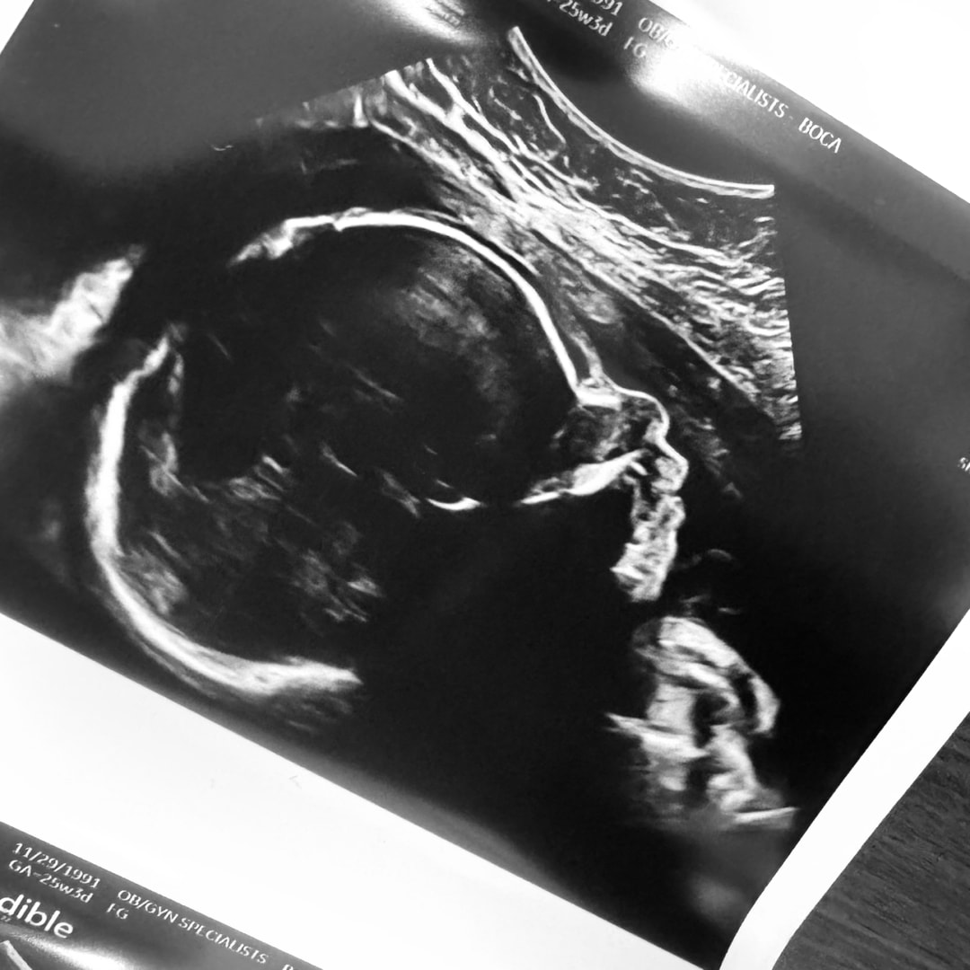 Photo shared by Cassandra for their Babylist baby registry.