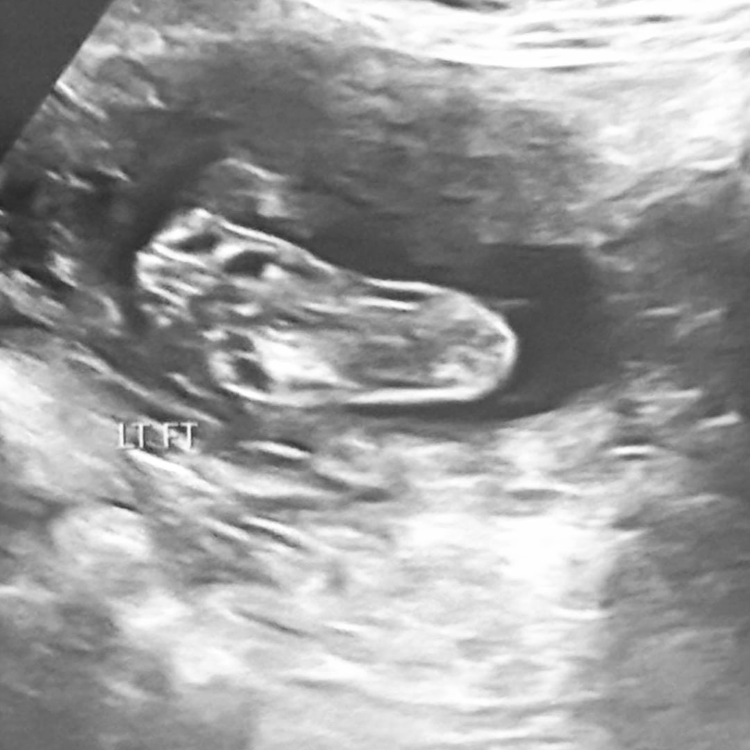 Photo shared by Akula for their Babylist baby registry.