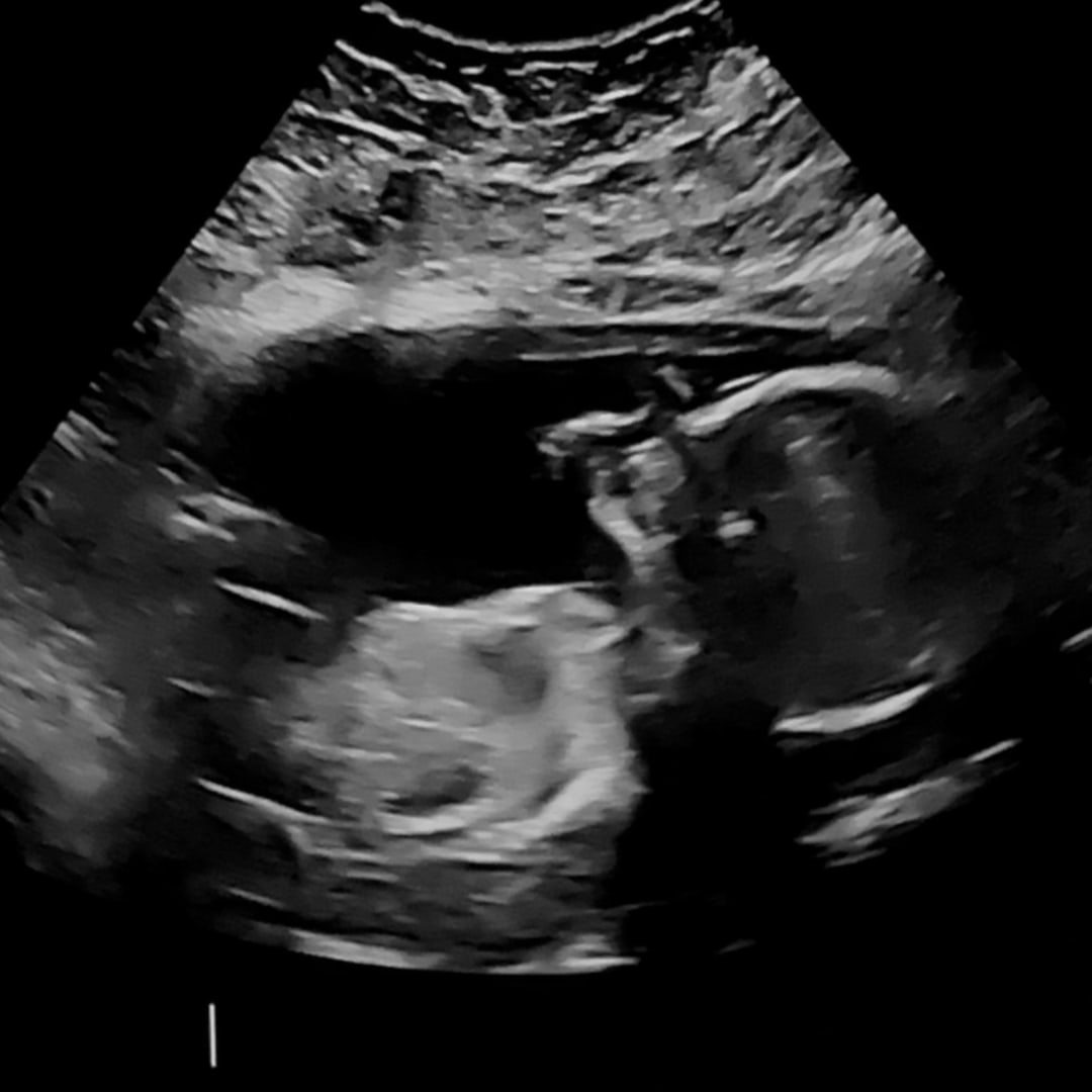 Photo shared by Ariel for their Babylist baby registry.