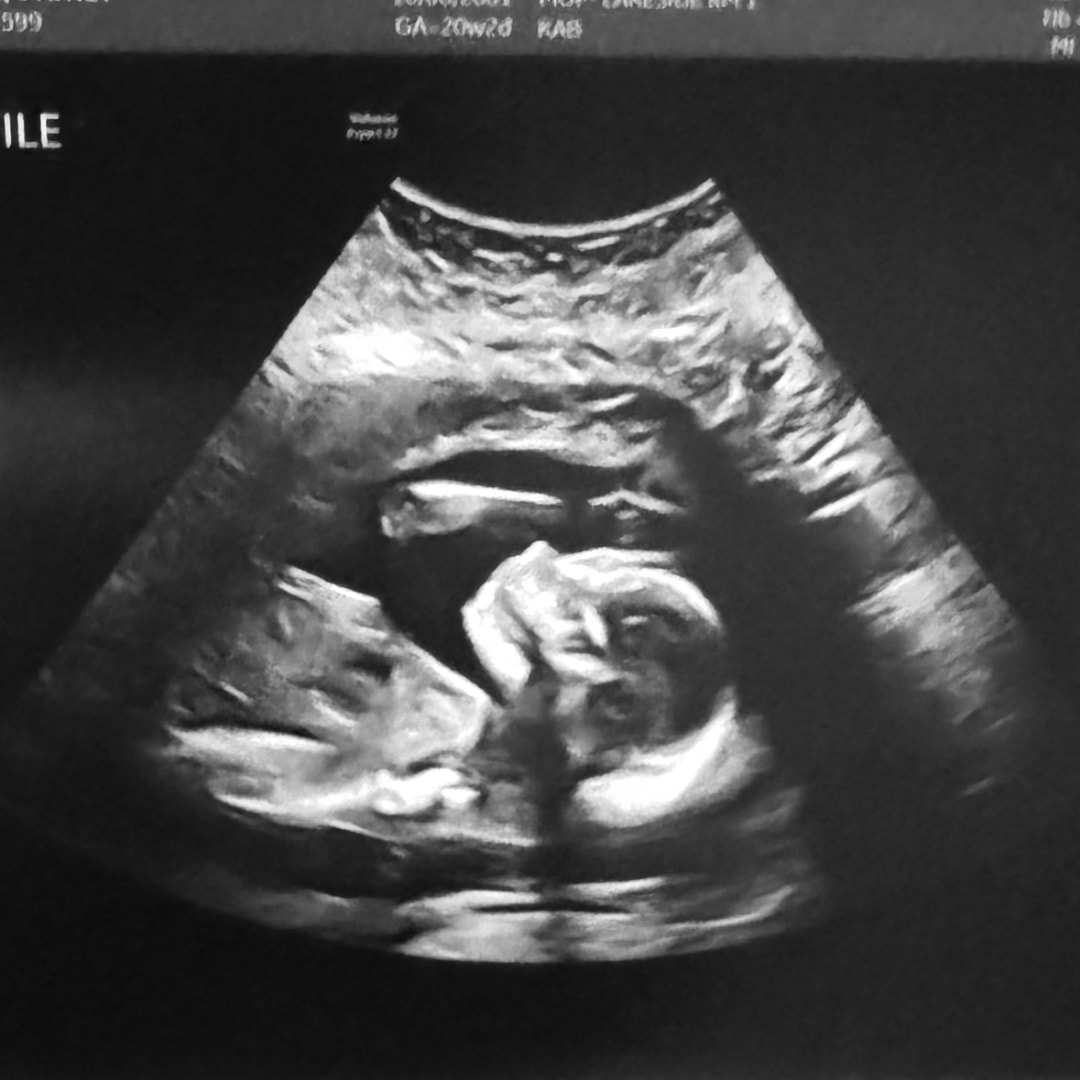 Photo shared by Sydney for their Babylist baby registry.