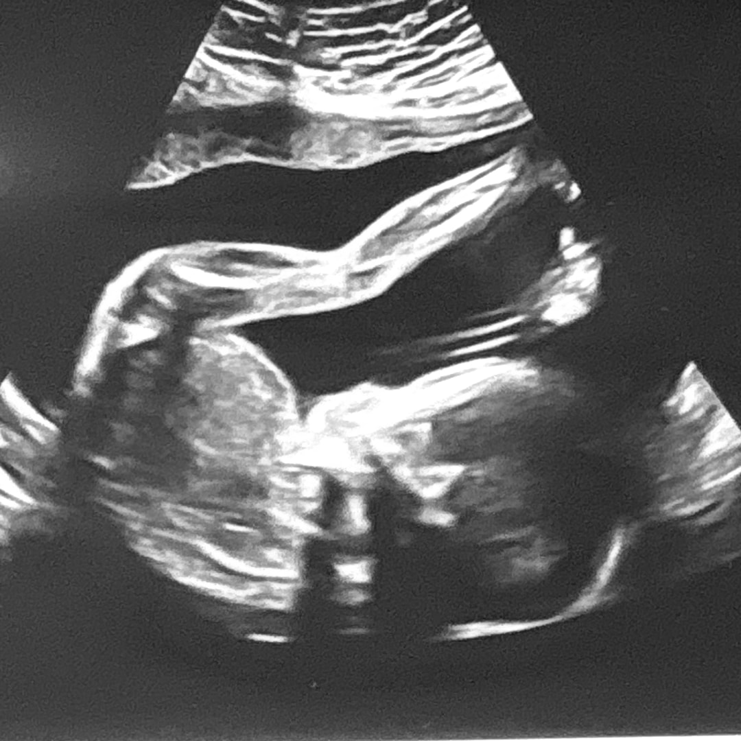 Photo shared by Audrie for their Babylist baby registry.