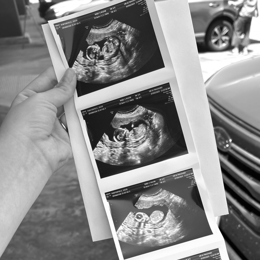 Photo shared by Jolie for their Babylist baby registry.