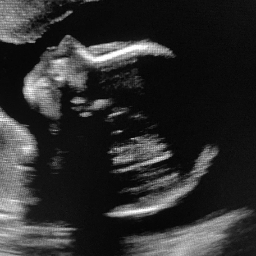 Photo shared by Erin for their Babylist baby registry.