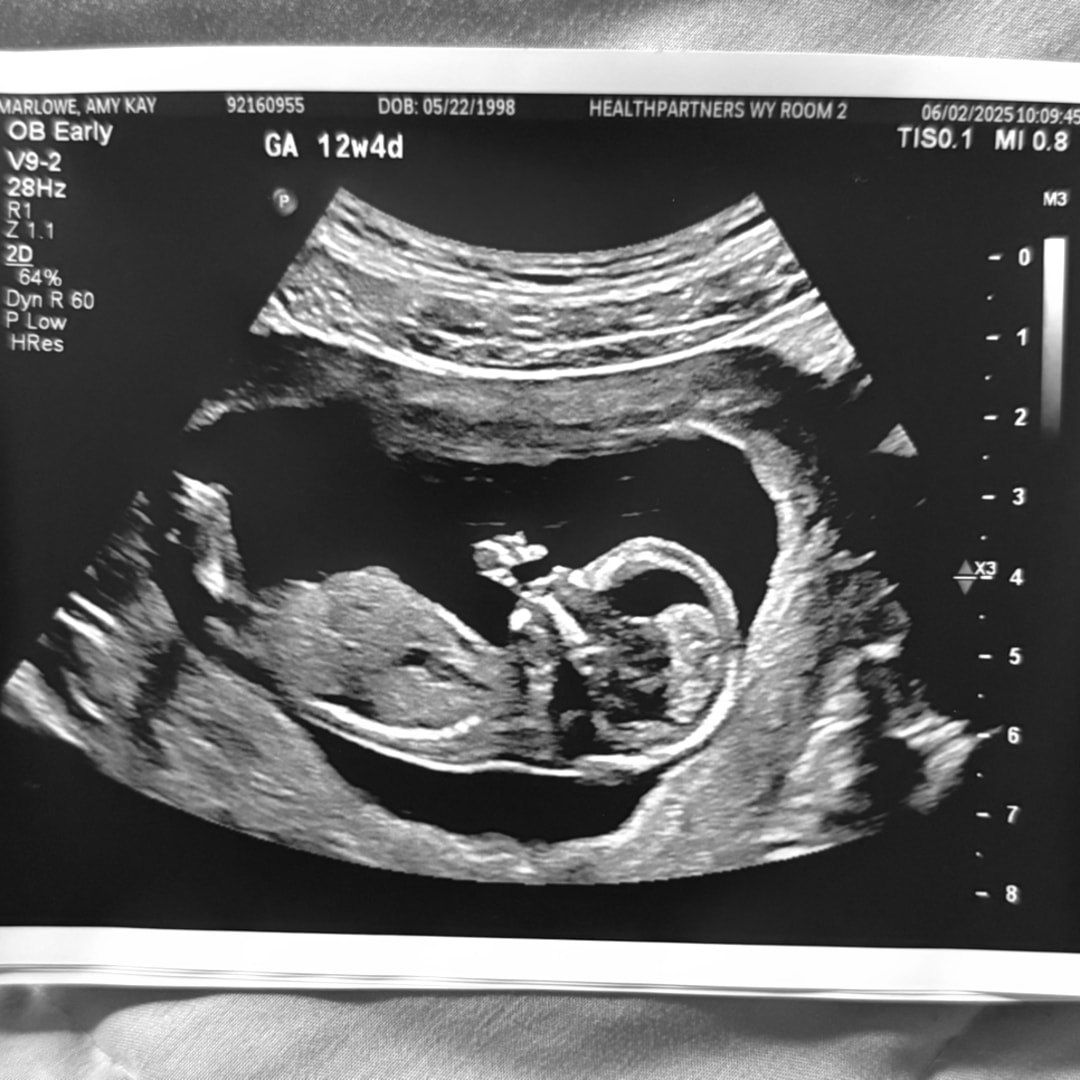 Photo shared by Amy for their Babylist baby registry.