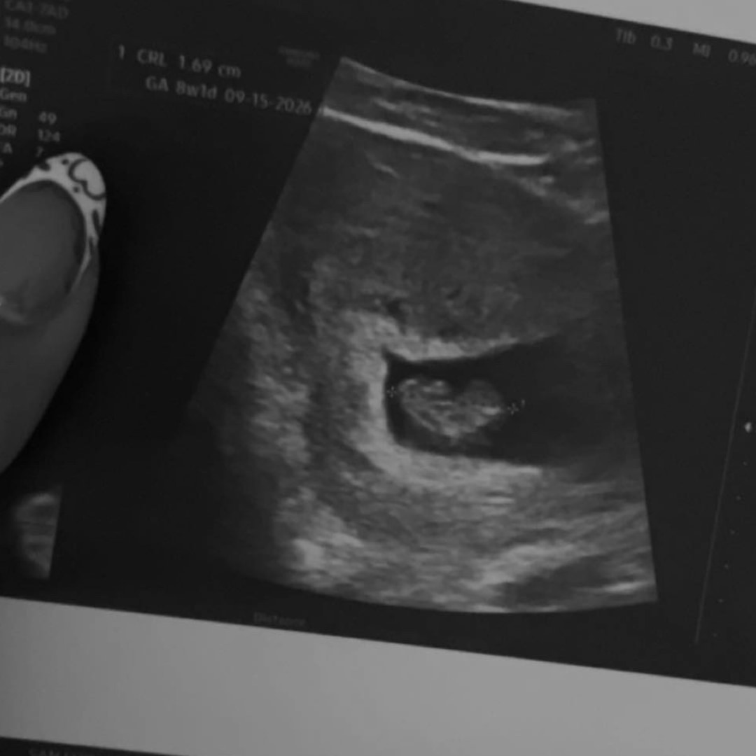 Photo shared by Anel for their Babylist baby registry.