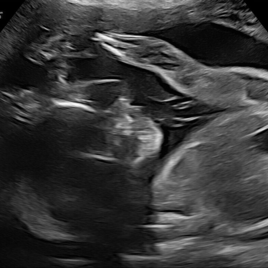 Photo shared by Meagan for their Babylist baby registry.