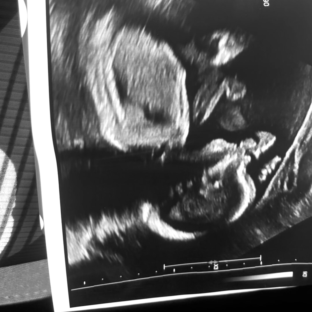 Photo shared by Jamari for their Babylist baby registry.
