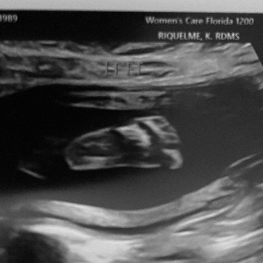 Photo shared by Amy for their Babylist baby registry.