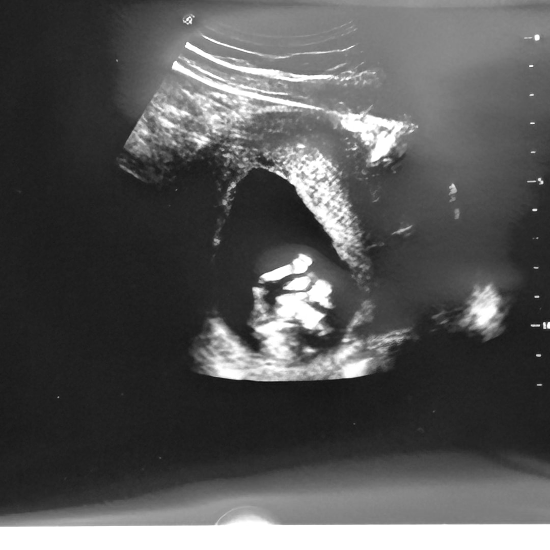 Photo shared by Alana for their Babylist baby registry.