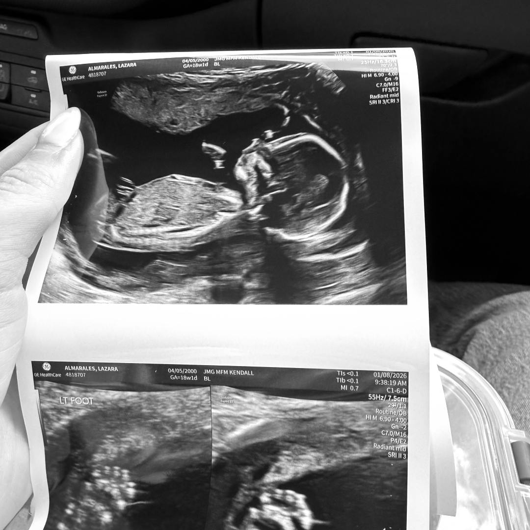 Photo shared by Lucy for their Babylist baby registry.