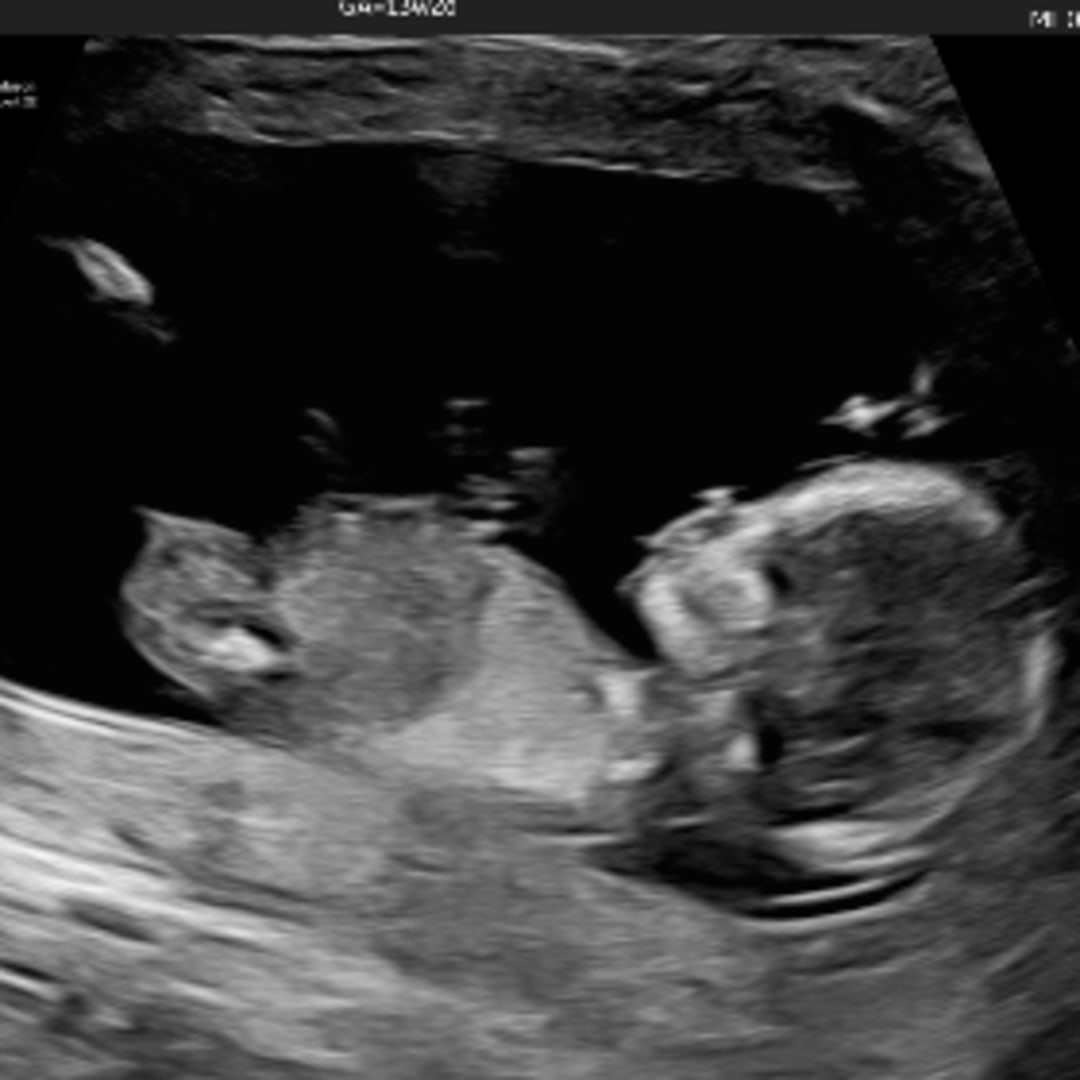 Photo shared by Jade for their Babylist baby registry.
