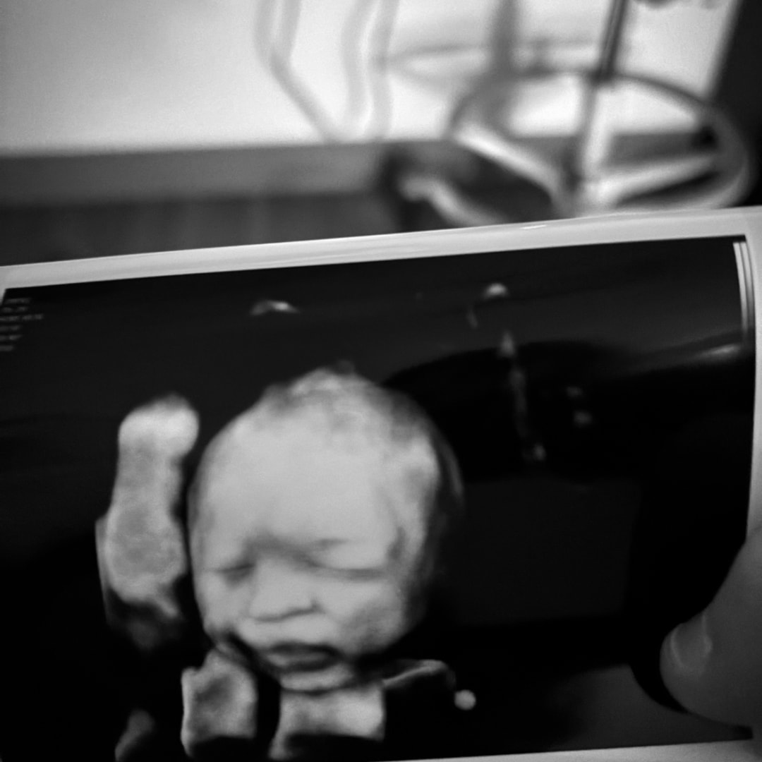 Photo shared by Madison for their Babylist baby registry.