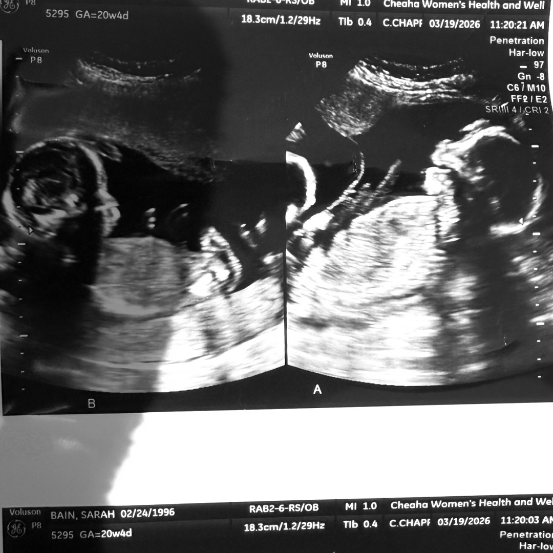 Photo shared by Sarah for their Babylist baby registry.