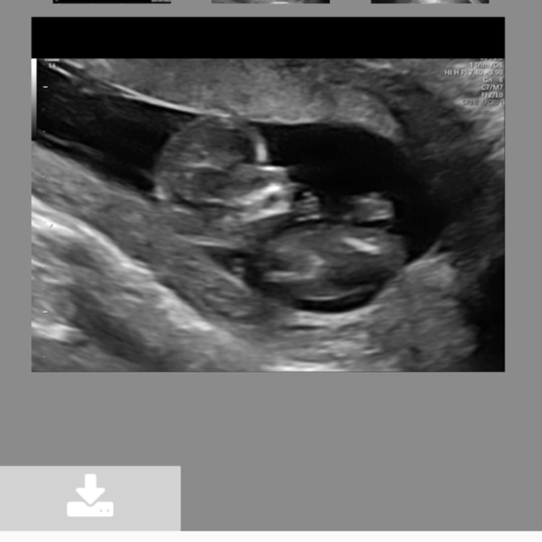 Photo shared by Tyler for their Babylist baby registry.