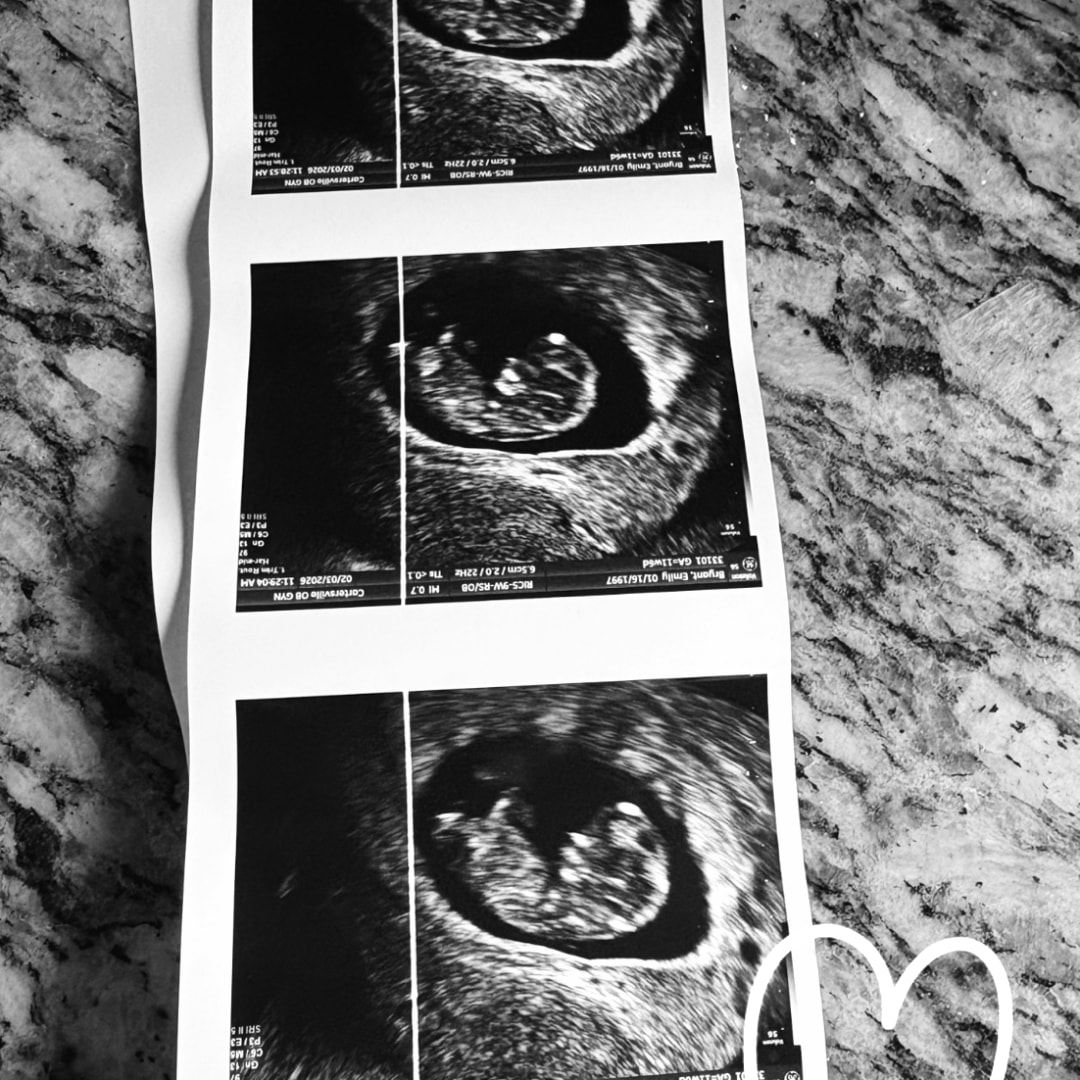 Photo shared by Emily for their Babylist baby registry.