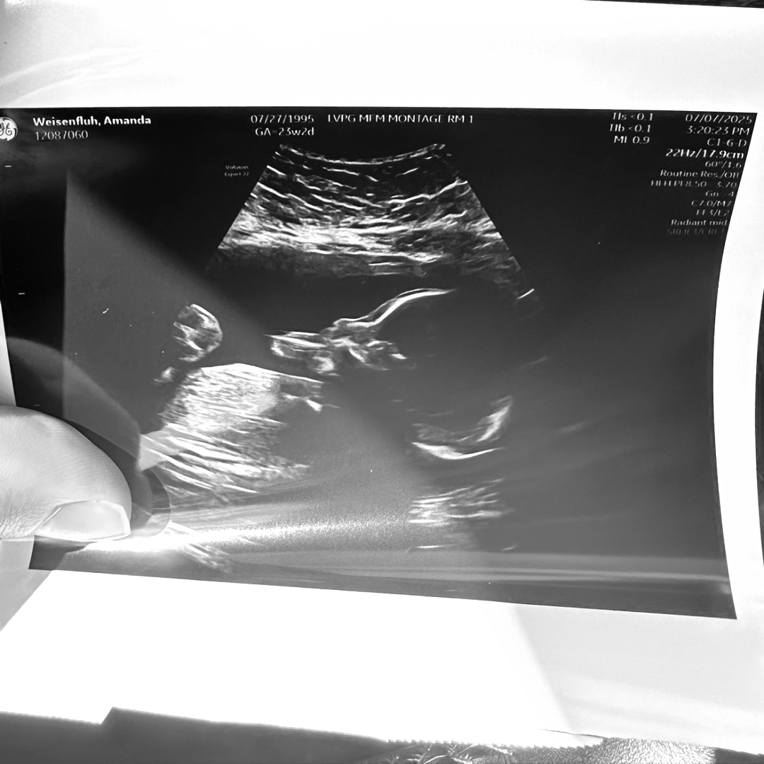 Photo shared by Amanda for their Babylist baby registry.