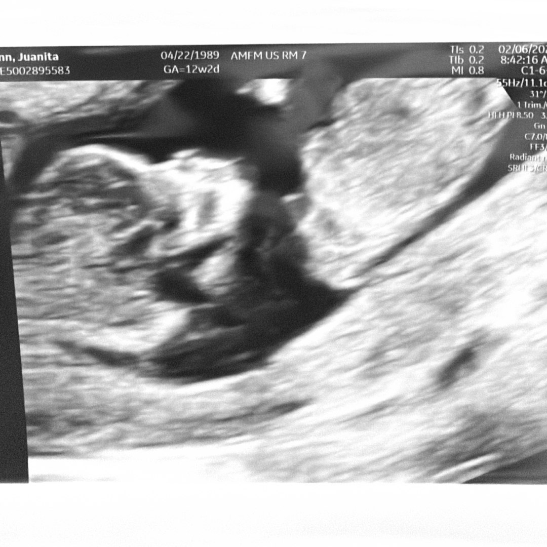 Photo shared by Juanita for their Babylist baby registry.