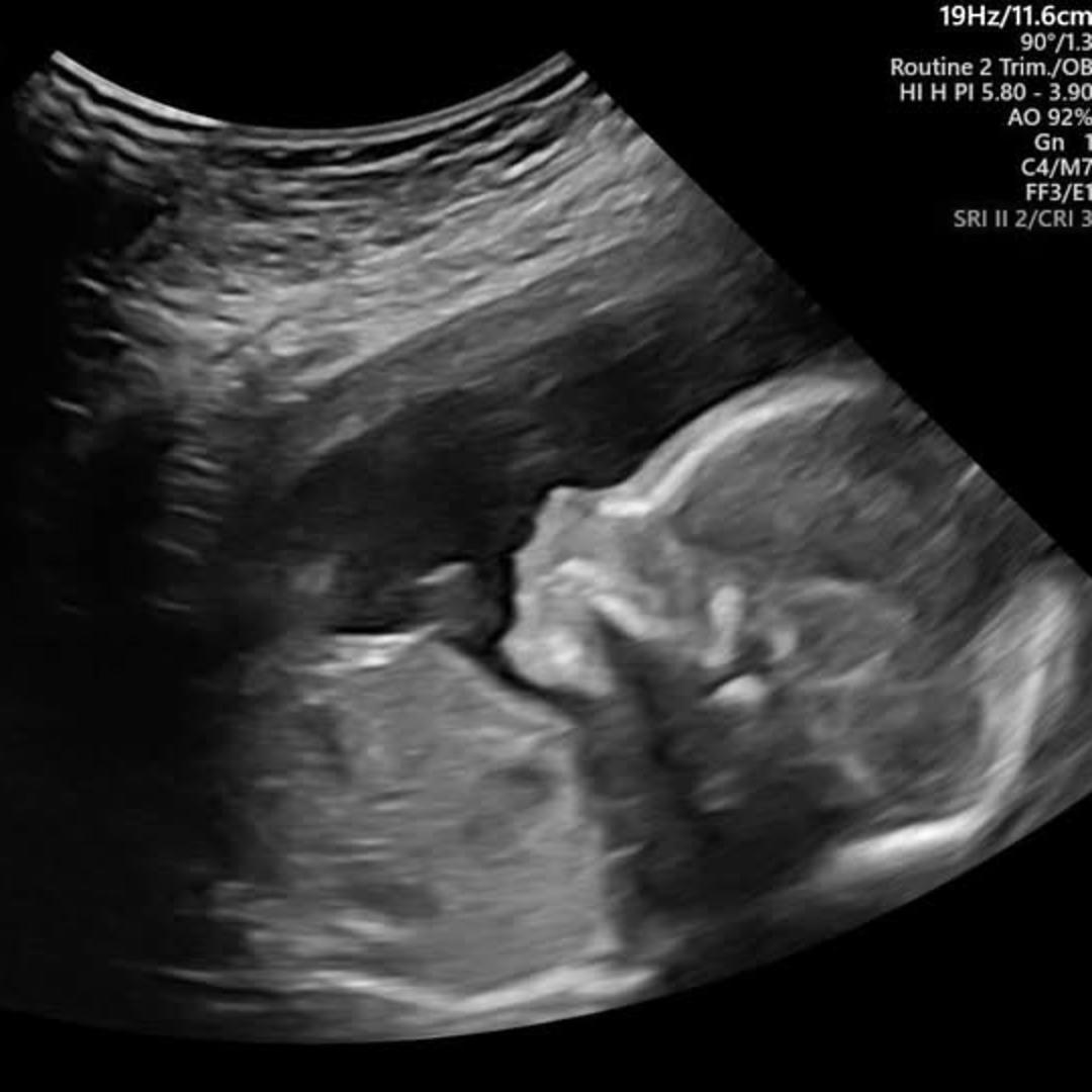 Photo shared by Abby for their Babylist baby registry.