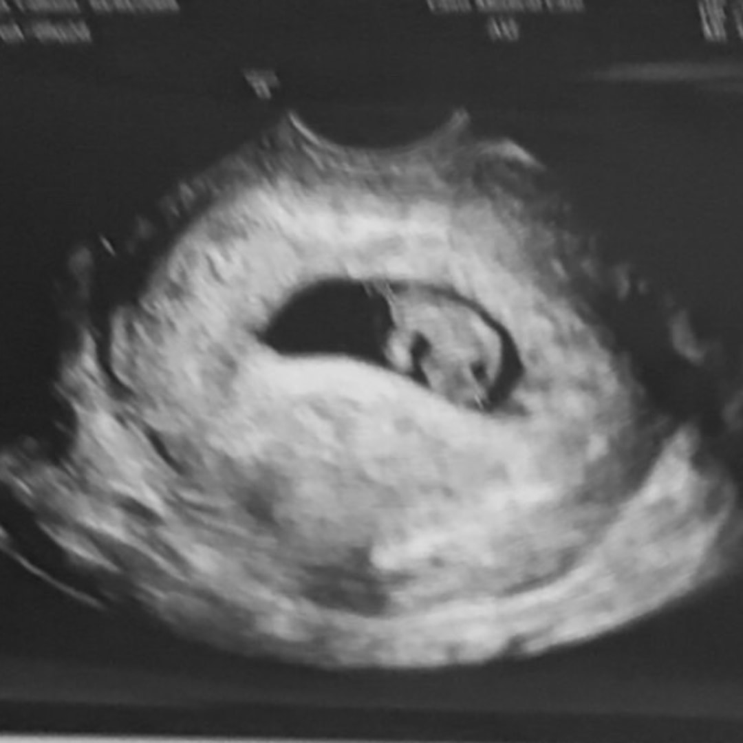Photo shared by Calliana for their Babylist baby registry.