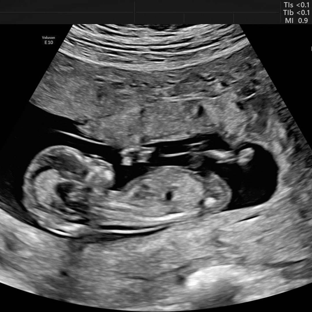 Photo shared by Gifany Ten-Ten for their Babylist baby registry.