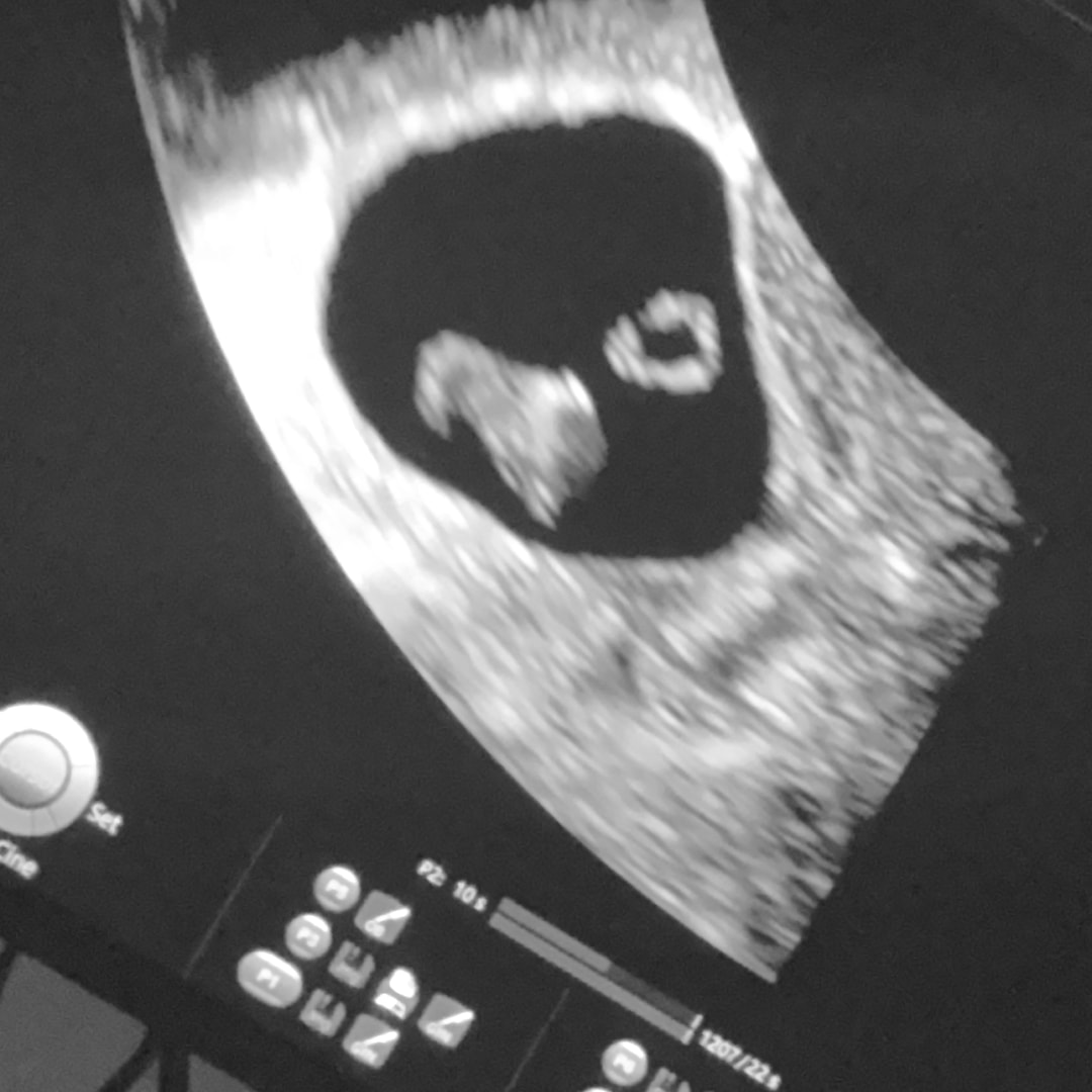 Photo shared by Diana for their Babylist baby registry.