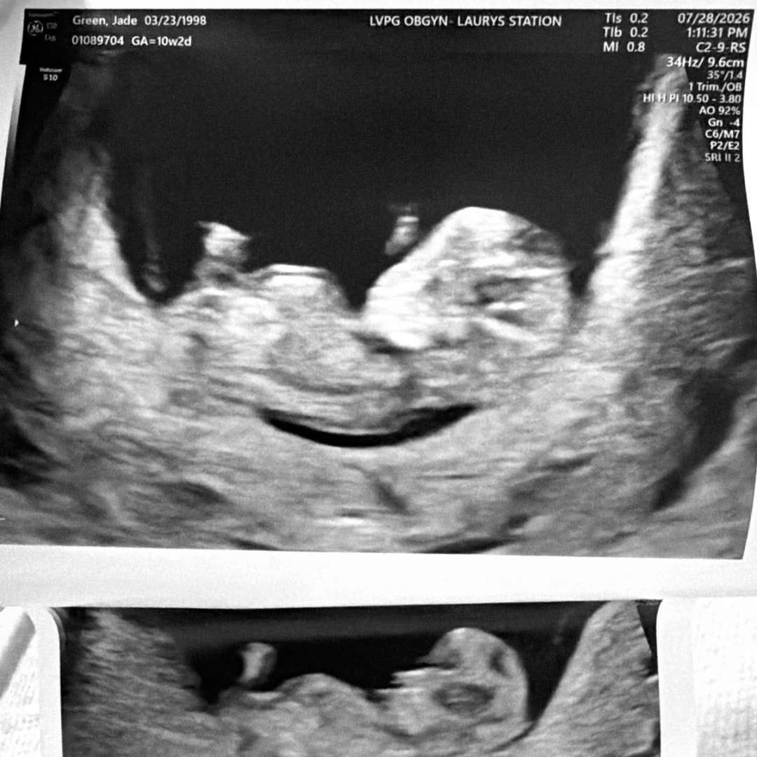 Photo shared by Jade for their Babylist baby registry.