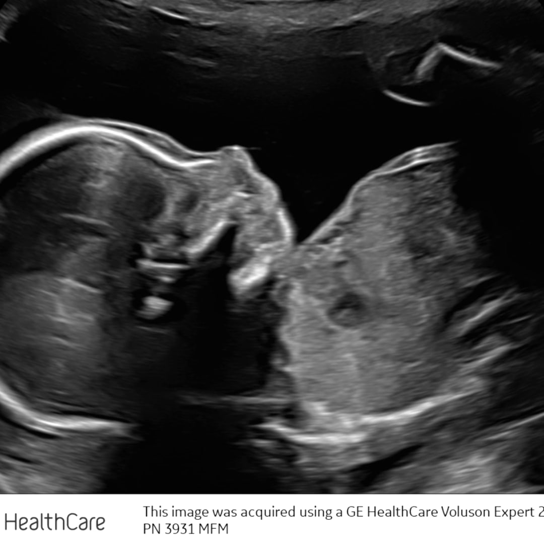 Photo shared by Brittni for their Babylist baby registry.
