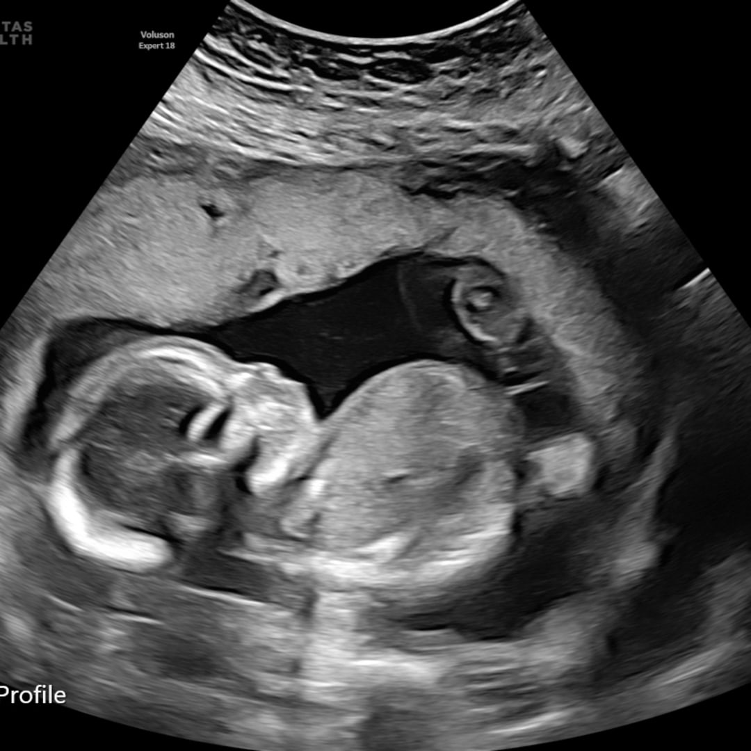 Photo shared by Kelsey for their Babylist baby registry.