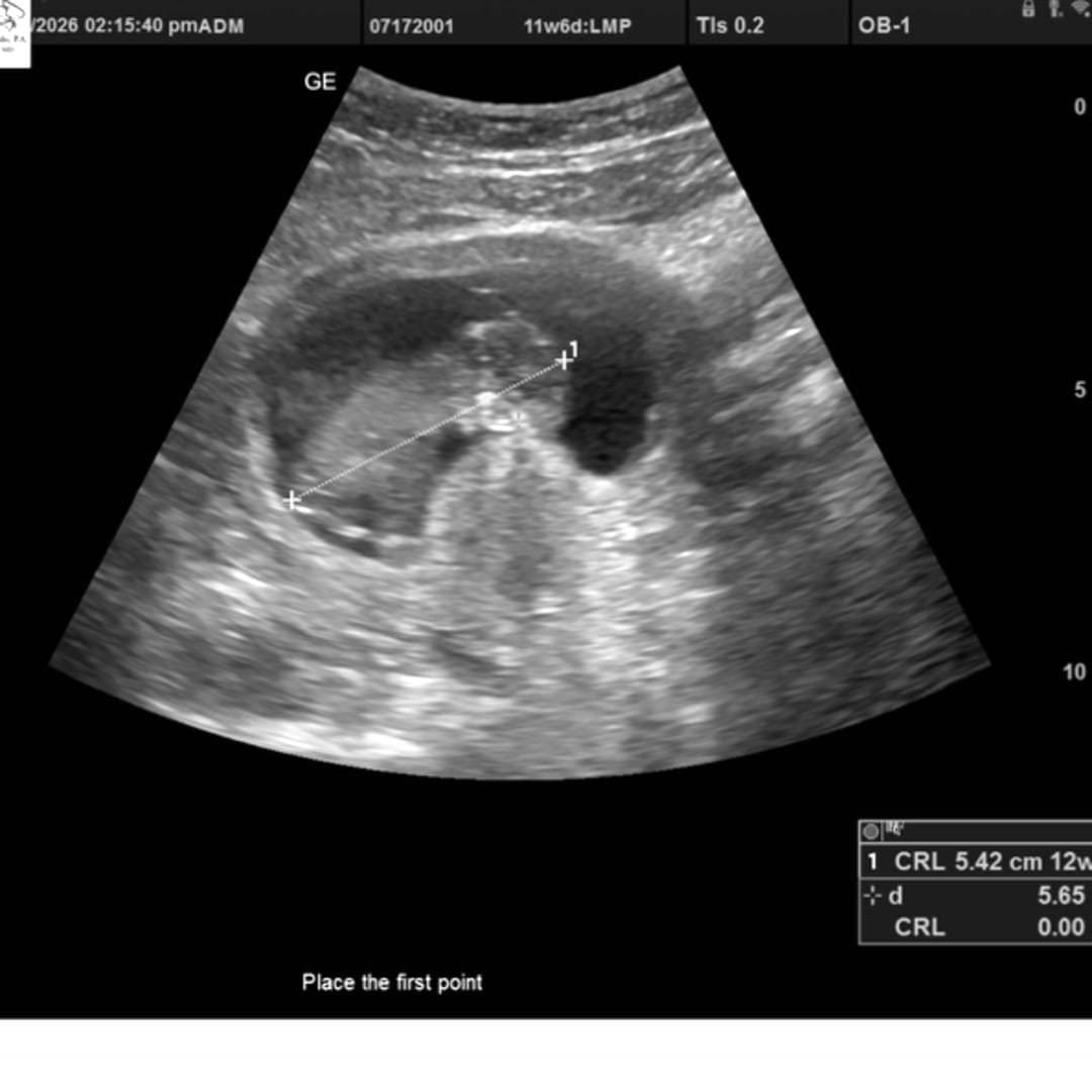 Photo shared by America for their Babylist baby registry.