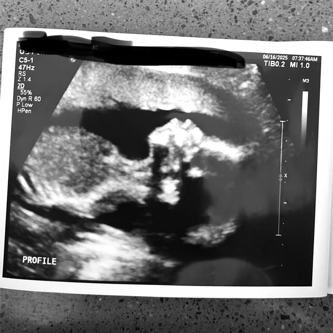 Photo shared by Skyler for their Babylist baby registry.