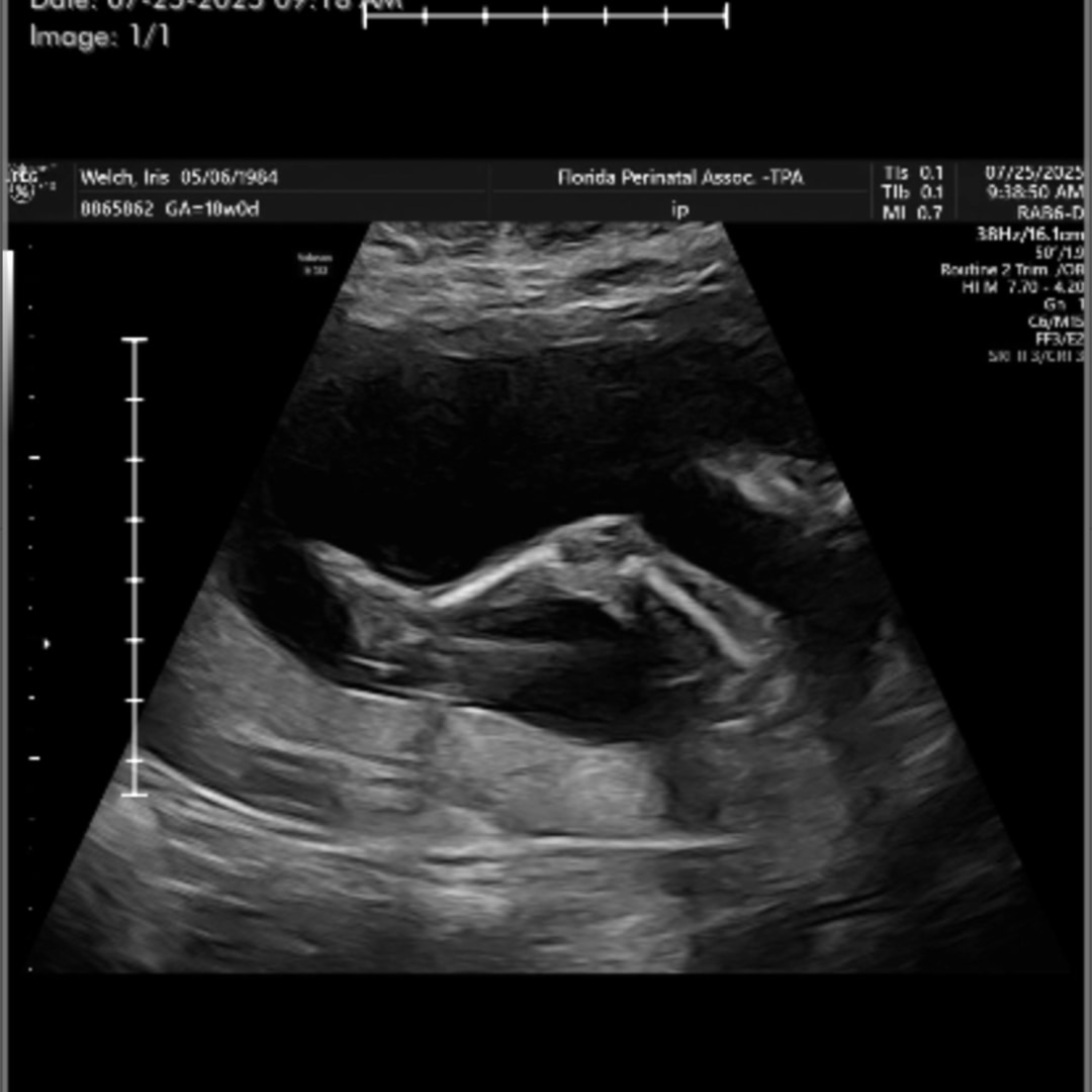 Photo shared by Iris for their Babylist baby registry.