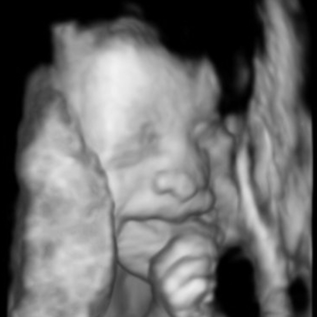 Photo shared by Alexandra for their Babylist baby registry.