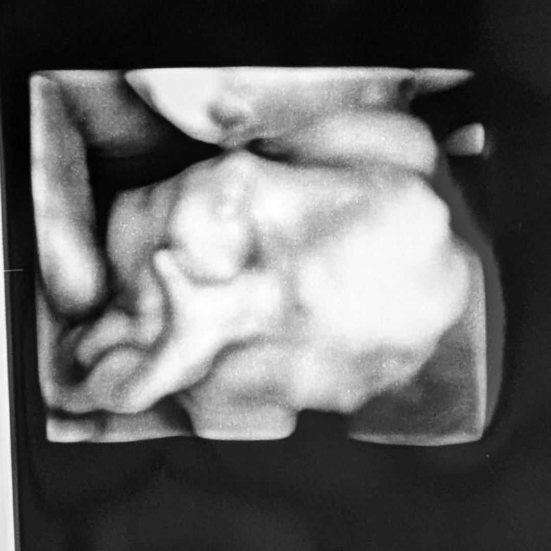 Photo shared by Ashelynn for their Babylist baby registry.