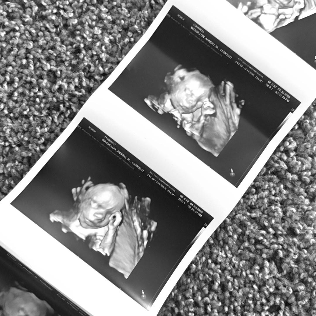 Photo shared by Anabel for their Babylist baby registry.