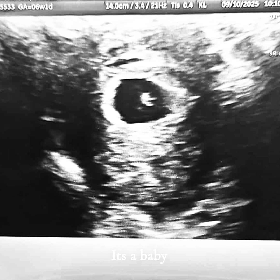 Photo shared by Kaylee for their Babylist baby registry.