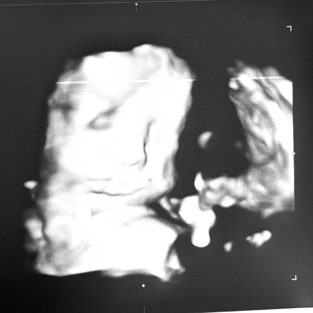 Photo shared by Kristin for their Babylist baby registry.