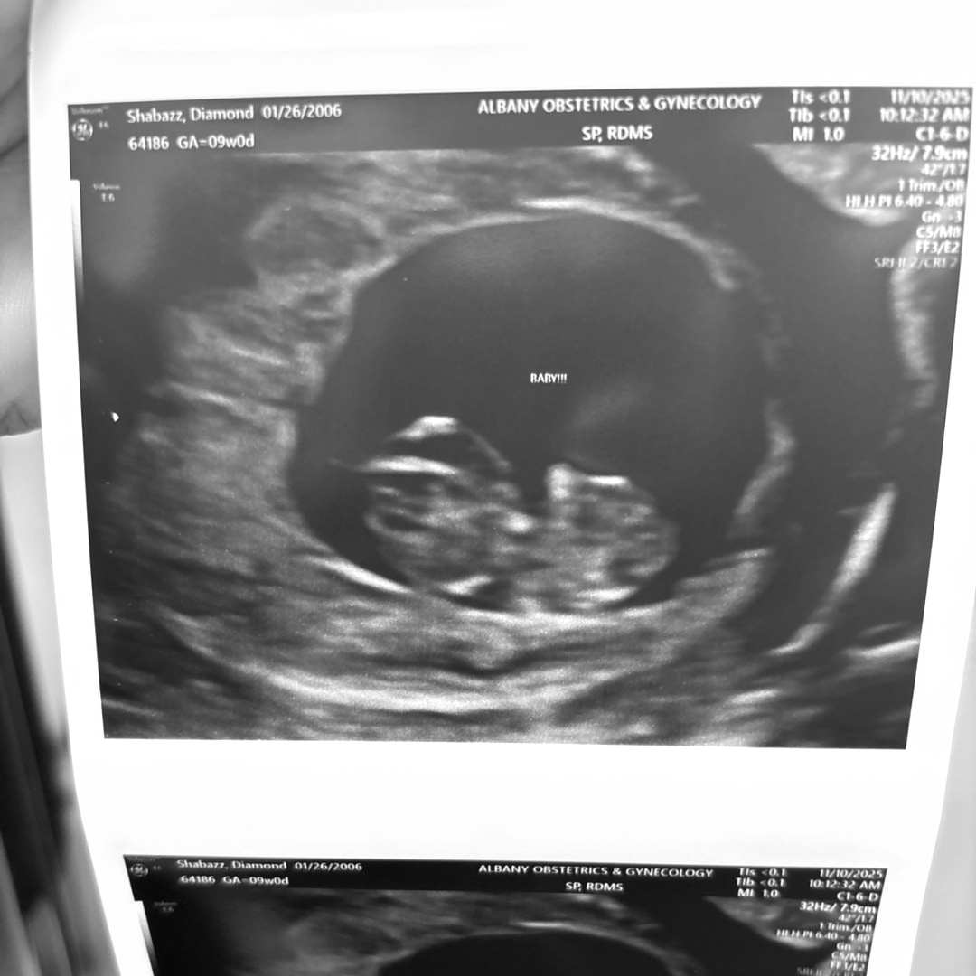Photo shared by Dymond for their Babylist baby registry.