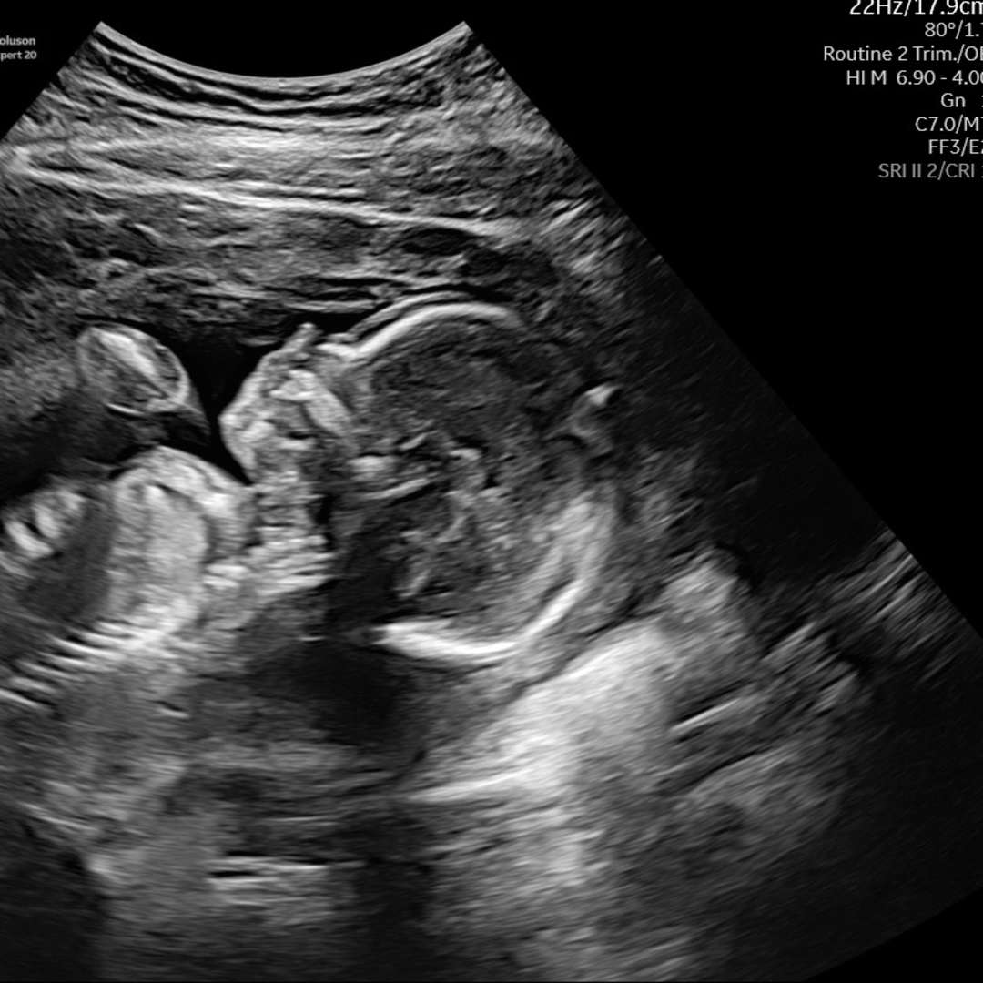 Photo shared by Karyssa for their Babylist baby registry.