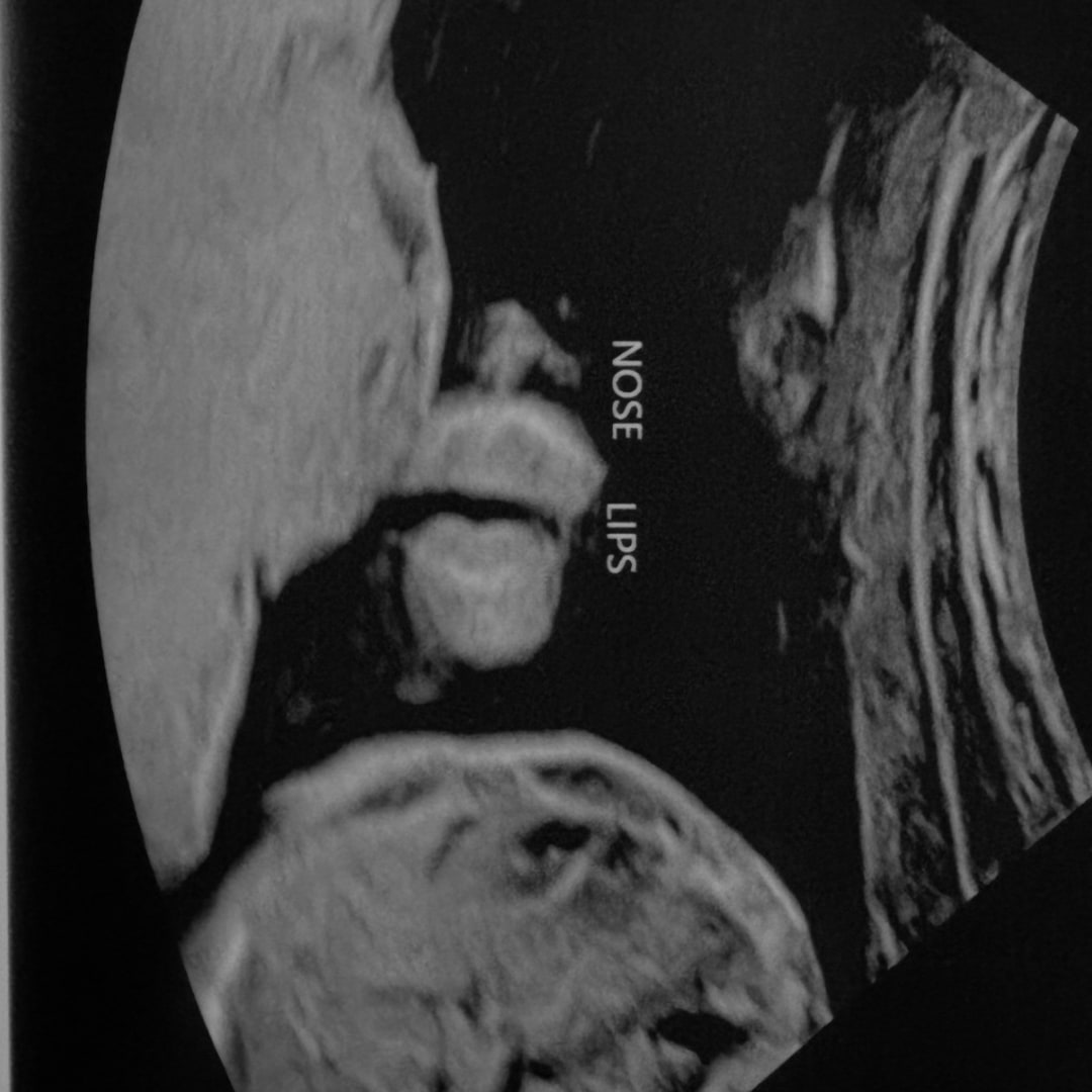 Photo shared by Aaliyah for their Babylist baby registry.