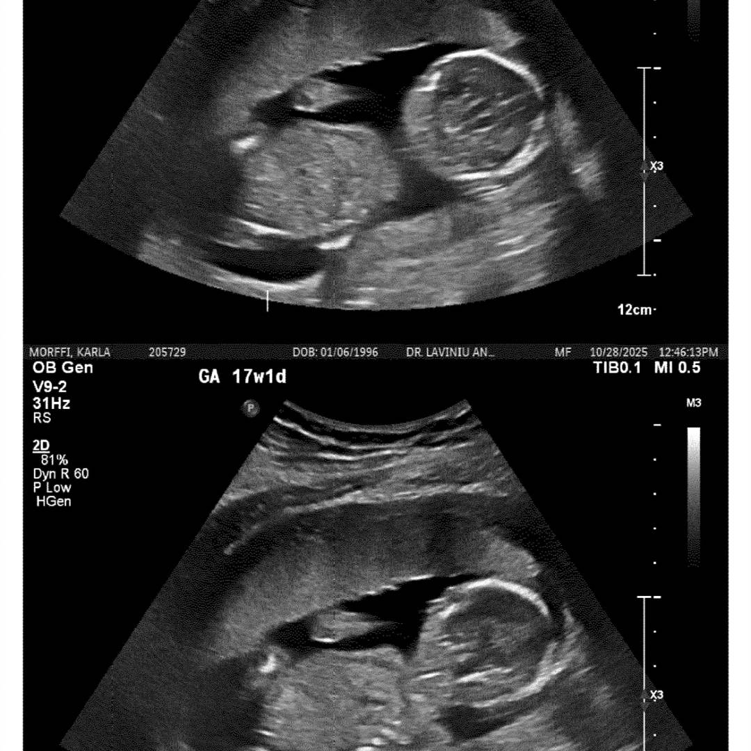 Photo shared by Karla for their Babylist baby registry.