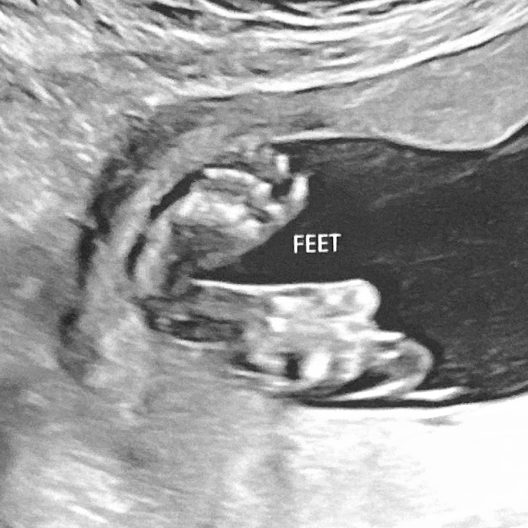 Photo shared by Hayley for their Babylist baby registry.