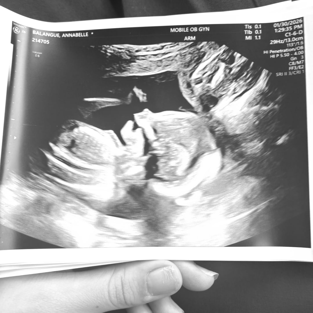 Photo shared by Annabelle for their Babylist baby registry.