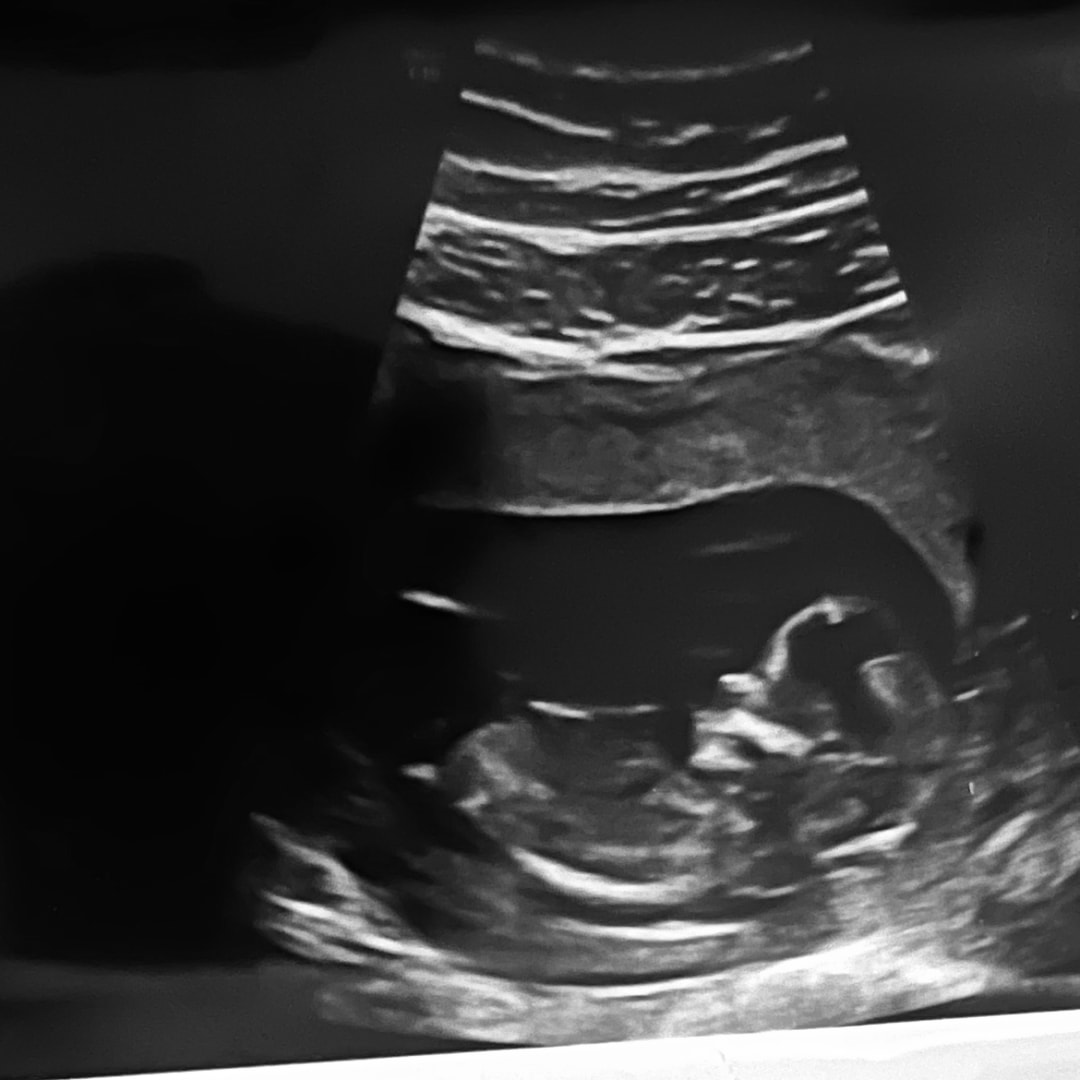 Photo shared by Bailee for their Babylist baby registry.