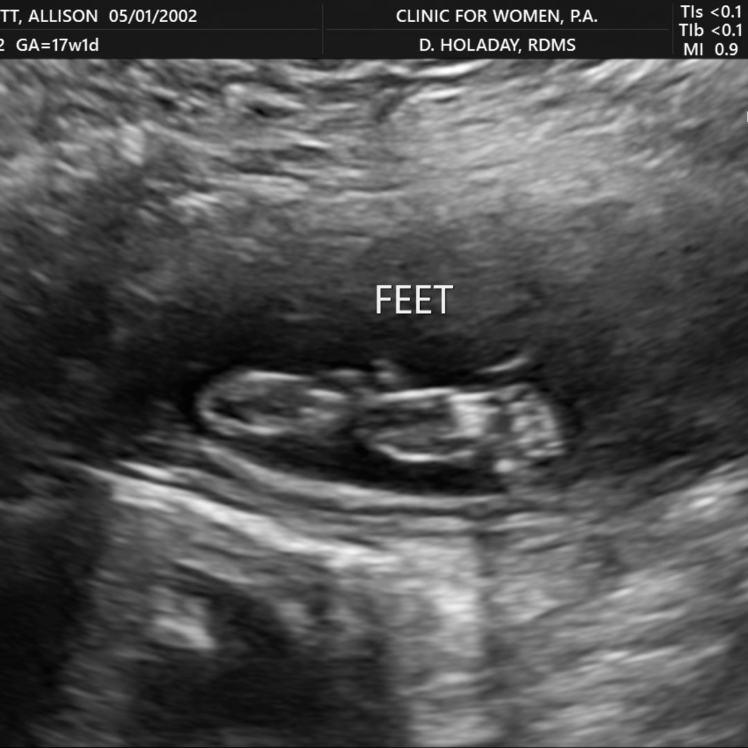 Photo shared by Allison for their Babylist baby registry.