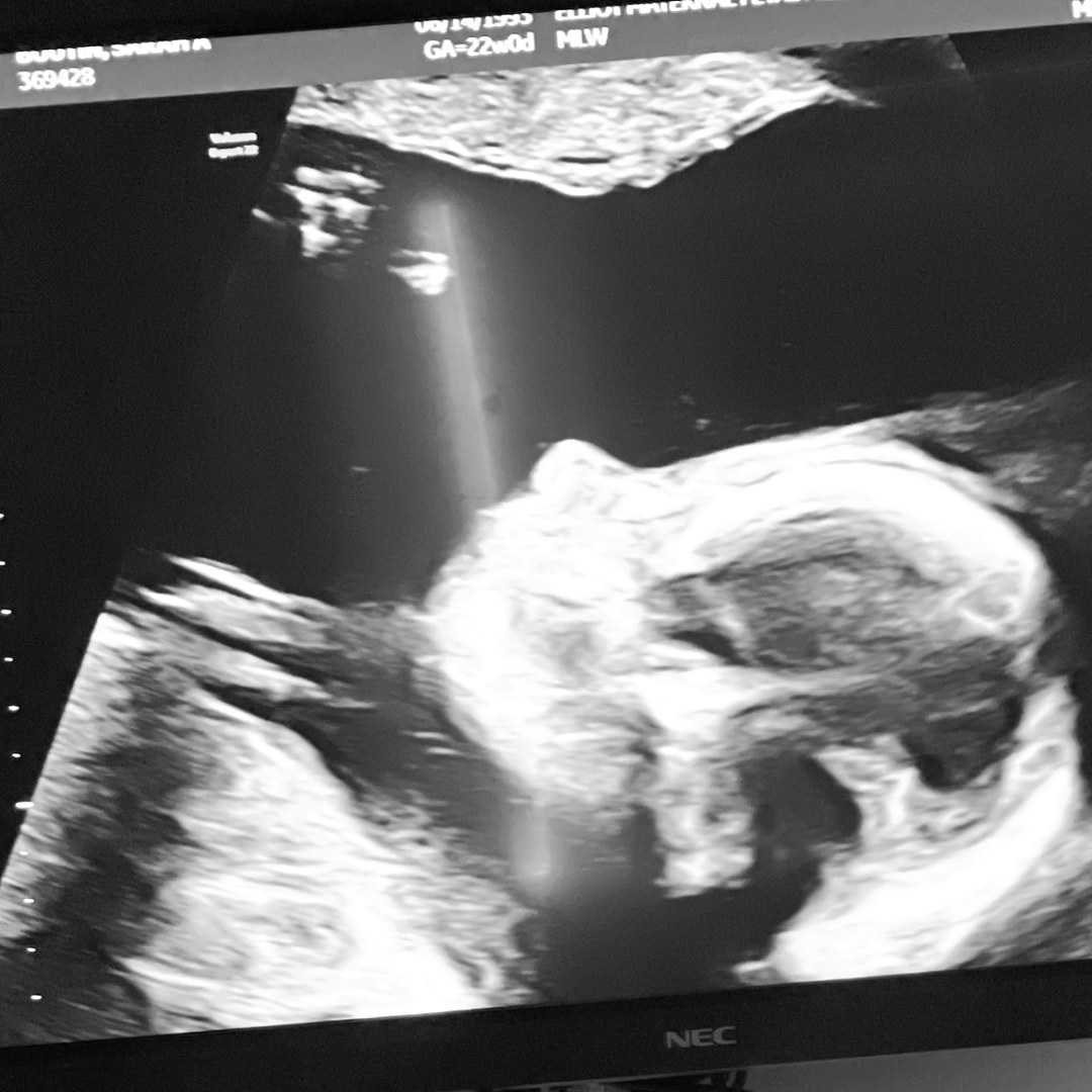 Photo shared by Sarah for their Babylist baby registry.