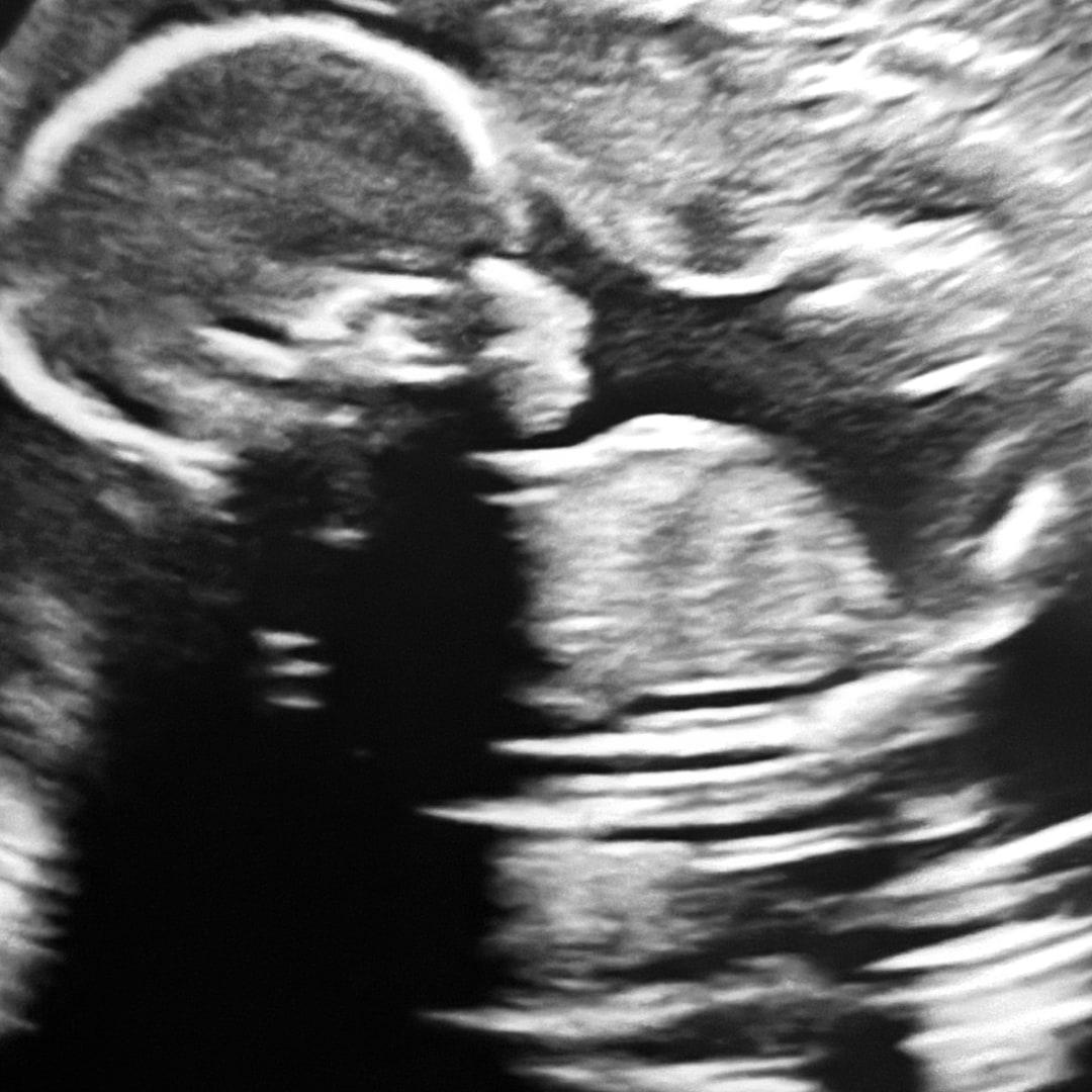 Photo shared by Naomi for their Babylist baby registry.