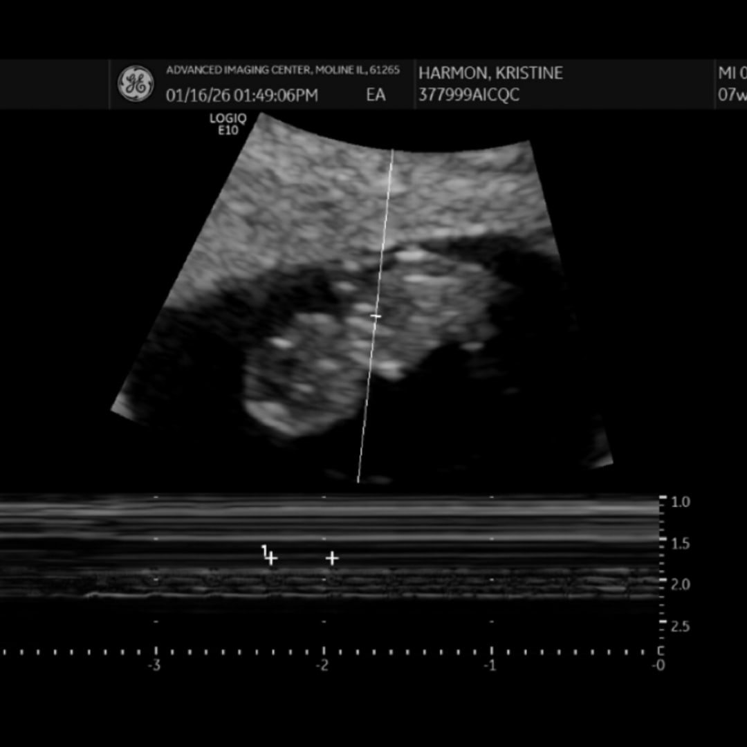 Photo shared by Kristine for their Babylist baby registry.