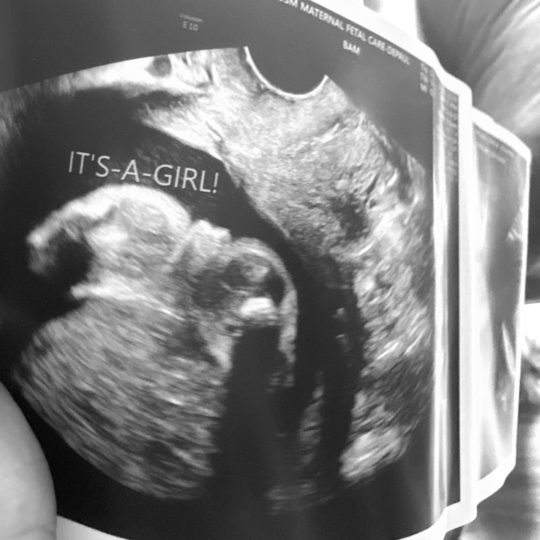 Photo shared by Dorisa for their Babylist baby registry.